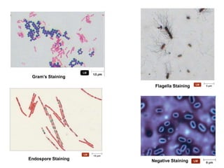 Gram’s Staining
Flagella Staining
Endospore Staining Negative Staining
 
