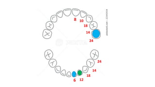 6
8 10
12
18
18
14
14
24
24
 