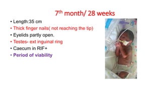 7th month/ 28 weeks
• Length:35 cm
• Thick finger nails( not reaching the tip)
• Eyelids partly open.
• Testes- ext inguinal ring
• Caecum in RIF+
• Period of viability
 