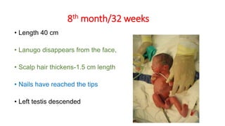 8th month/32 weeks
• Length 40 cm
• Lanugo disappears from the face,
• Scalp hair thickens-1.5 cm length
• Nails have reached the tips
• Left testis descended
 
