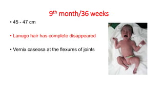 9th month/36 weeks
• 45 - 47 cm
• Lanugo hair has complete disappeared
• Vernix caseosa at the flexures of joints
 