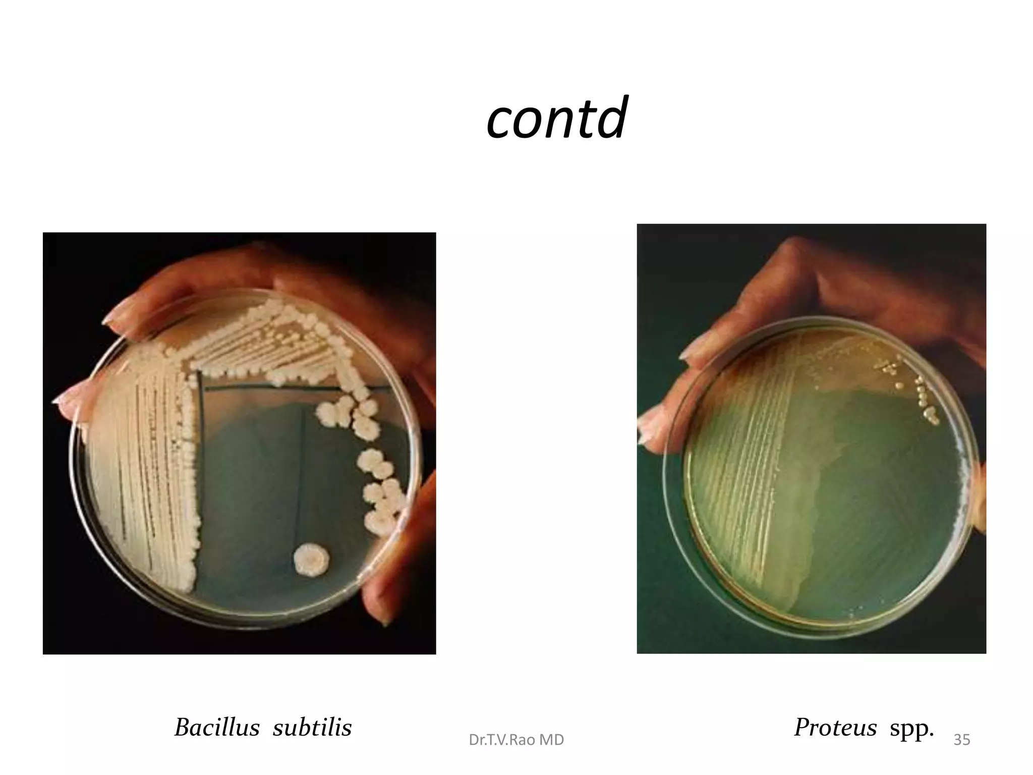 contd
Bacillus subtilis Proteus spp.
Dr.T.V.Rao MD 35
 