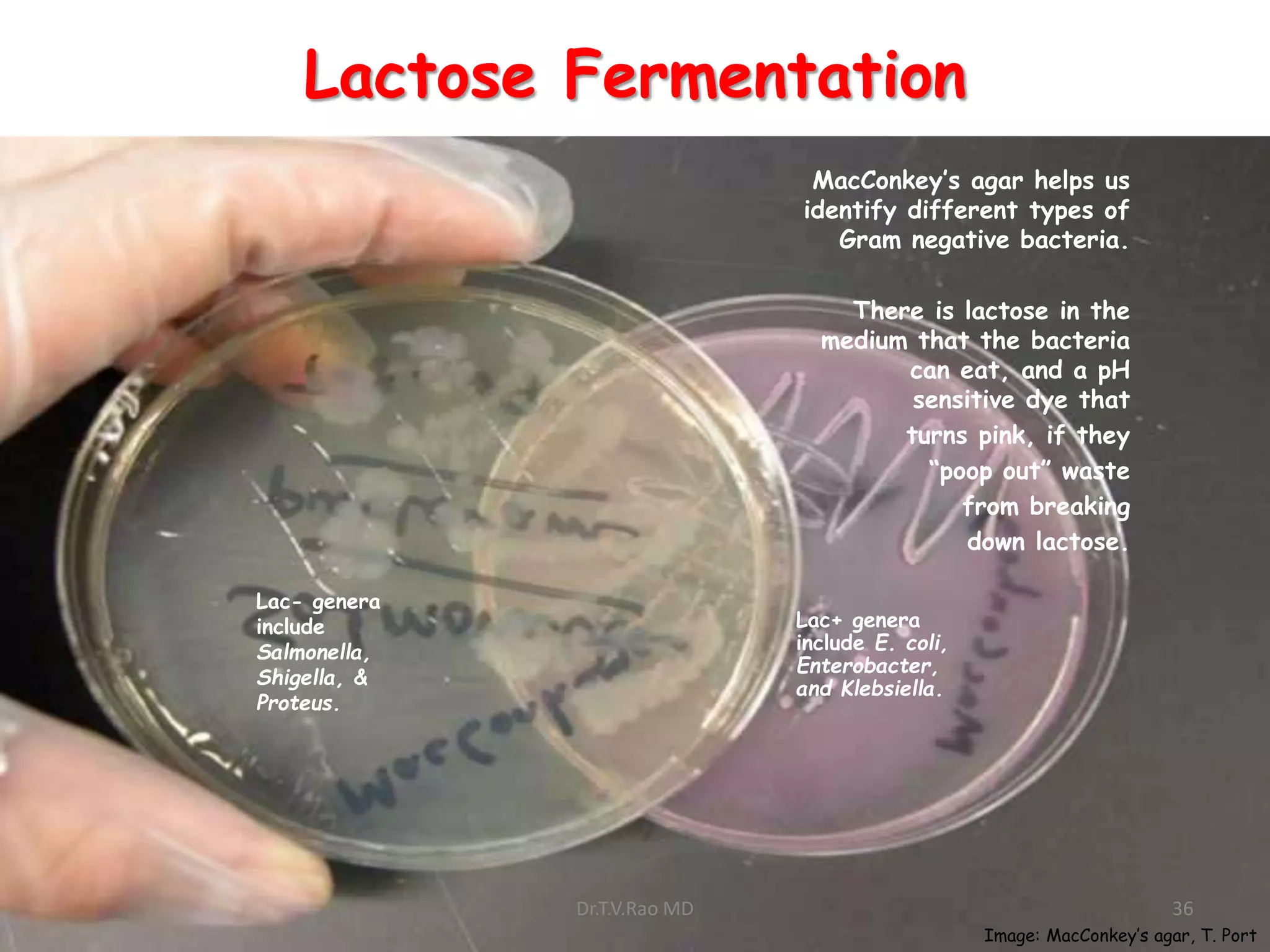 Lactose Fermentation
MacConkey’s agar helps us
identify different types of
Gram negative bacteria.
There is lactose in the
medium that the bacteria
can eat, and a pH
sensitive dye that
turns pink, if they
“poop out” waste
from breaking
down lactose.
Lac+ genera
include E. coli,
Enterobacter,
and Klebsiella.
Lac- genera
include
Salmonella,
Shigella, &
Proteus.
Image: MacConkey’s agar, T. Port
Dr.T.V.Rao MD 36
 