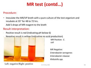 Mr Test Example Basics in Identification of Bacteria by Dr.T.V.Rao MD | PPTX