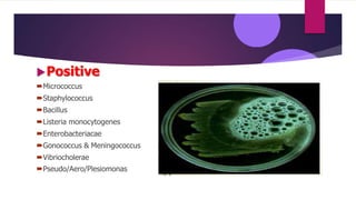 Positive
Micrococcus
Staphylococcus
Bacillus
Listeria monocytogenes
Enterobacteriacae
Gonococcus & Meningococcus
Vibriocholerae
Pseudo/Aero/Plesiomonas
 