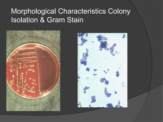 Morphological Characteristics Colony
Isolation & Gram Stain
 