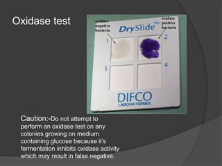 Oxidase test
Caution:-Do not attempt to
perform an oxidase test on any
colonies growing on medium
containing glucose because it’s
fermentation inhibits oxidase activity
which may result in false negative.
 