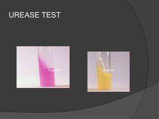 UREASE TEST
Positive Negative
 