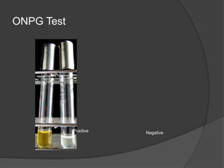 ONPG Test
Positive Negative
 