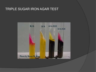 TRIPLE SUGAR IRON AGAR TEST
 