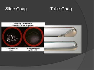 Slide Coag. Tube Coag.
 