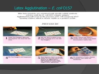 Latex Agglutination – E. coli O157
 