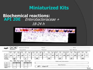 Miniaturized Kits
API 20E Enterobacteriaceae +
18-24 h
Generate profile #
Biochemical reactions:
 