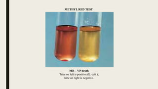Identification of bacteria by biochemical tests | PPTX