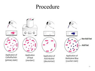 Identification of bacteria by staining methods | PPTX