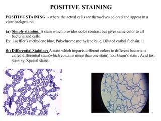 Simple Staining Methods Identification of bacteria by staining methods | PPTX