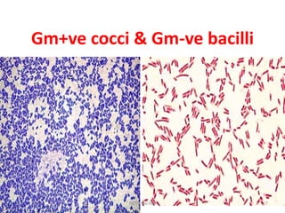 Gm+ve cocci & Gm-ve bacilli
17Dr.T.V.Rao MD
 