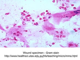 Wound specimen - Gram stain
http://www.healthsci.utas.edu.au/hls/teaching/micro/mma.htmlDr.T.V.Rao MD 21
 