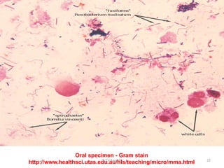 Oral specimen - Gram stain
http://www.healthsci.utas.edu.au/hls/teaching/micro/mma.htmlDr.T.V.Rao MD 22
 