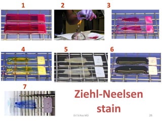 Ziehl-Neelsen
stain
4 5 6
7
1 2 3
26Dr.T.V.Rao MD
 