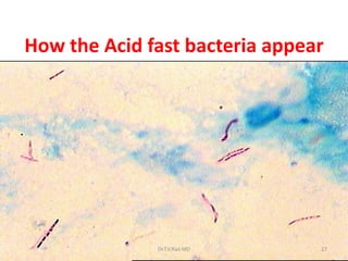 How the Acid fast bacteria appear
27Dr.T.V.Rao MD
 