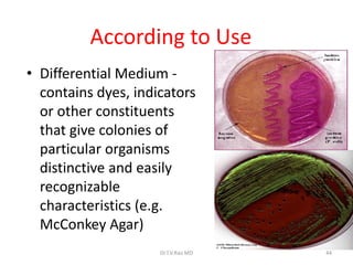 According to Use
• Differential Medium -
contains dyes, indicators
or other constituents
that give colonies of
particular organisms
distinctive and easily
recognizable
characteristics (e.g.
McConkey Agar)
Dr.T.V.Rao MD 44
 