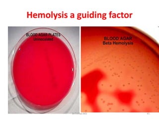 Hemolysis a guiding factor
Dr.T.V.Rao MD 45
 