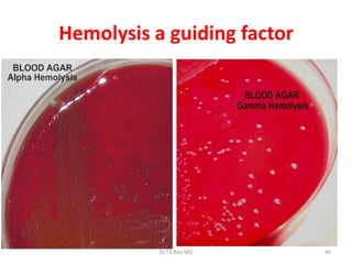 Hemolysis a guiding factor
Dr.T.V.Rao MD 46
 