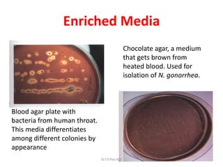 47
Enriched Media
Blood agar plate with
bacteria from human throat.
This media differentiates
among different colonies by
appearance
Chocolate agar, a medium
that gets brown from
heated blood. Used for
isolation of N. gonorrhea.
Dr.T.V.Rao MD
 