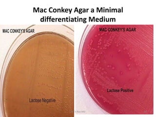 Mac Conkey Agar a Minimal
differentiating Medium
Dr.T.V.Rao MD 50
 