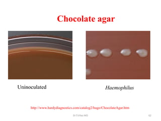 Chocolate agar
Uninoculated Haemophilus
http://www.hardydiagnostics.com/catalog2/hugo/ChocolateAgar.htm
Dr.T.V.Rao MD 62
 