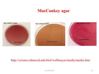 http://science.nhmccd.edu/biol/wellmeyer/media/media.htm
MacConkey agar
Dr.T.V.Rao MD 63
 