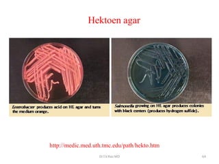 http://medic.med.uth.tmc.edu/path/hekto.htm
Hektoen agar
Dr.T.V.Rao MD 64
 