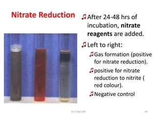 69
Nitrate Reduction ♫After 24-48 hrs of
incubation, nitrate
reagents are added.
♫Left to right:
♫Gas formation (positive
for nitrate reduction).
♫positive for nitrate
reduction to nitrite (
red colour).
♫Negative control
Dr.T.V.Rao MD
 