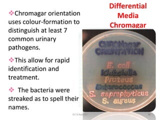 76
Differential
Media
Chromagar
Chromagar orientation
uses colour-formation to
distinguish at least 7
common urinary
pathogens.
This allow for rapid
identification and
treatment.
 The bacteria were
streaked as to spell their
names.
Dr.T.V.Rao MD
 