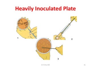 81
Heavily Inoculated Plate
Dr.T.V.Rao MD
 
