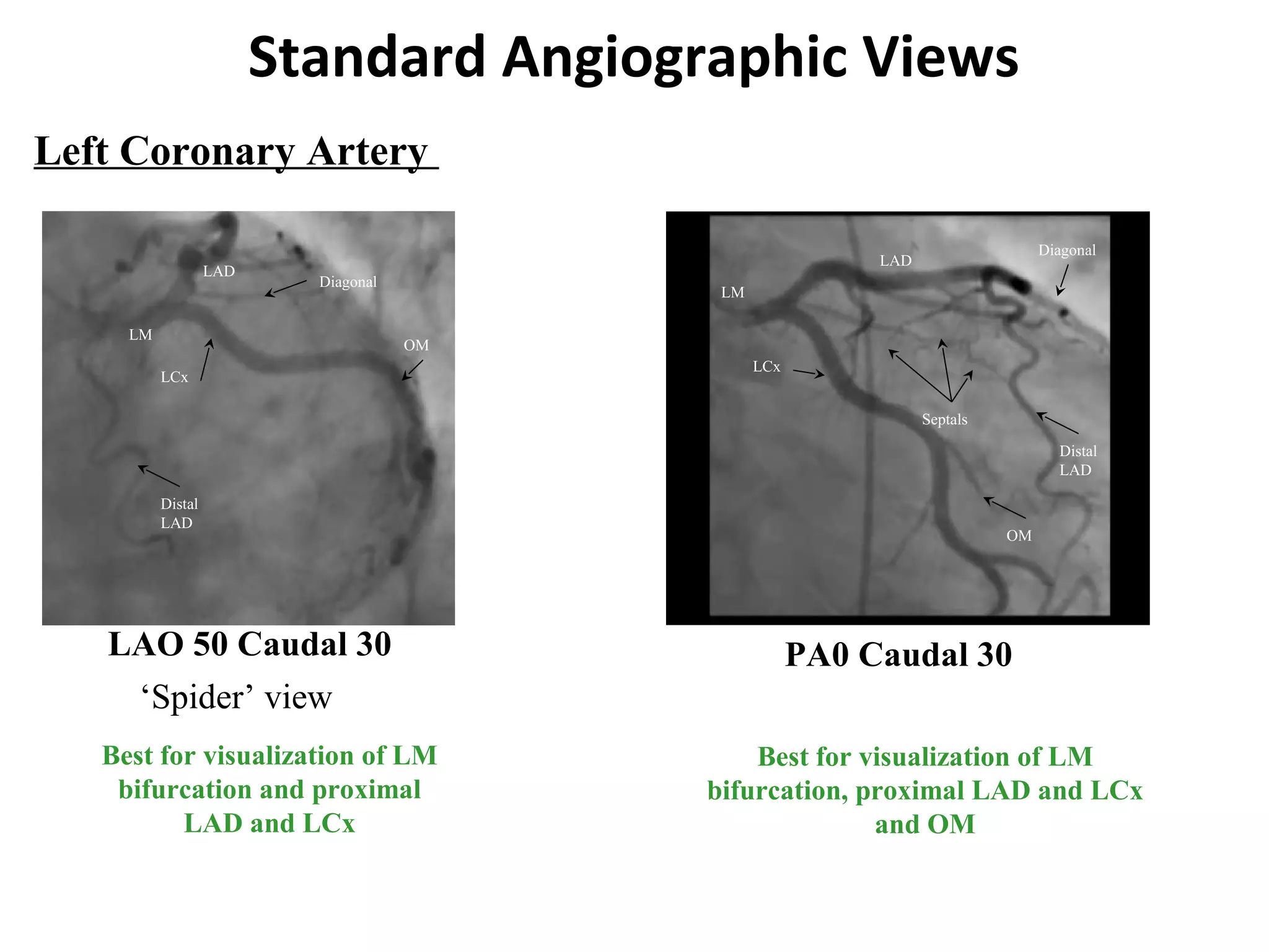 Identification of coronary arteries by different angiographic views ...