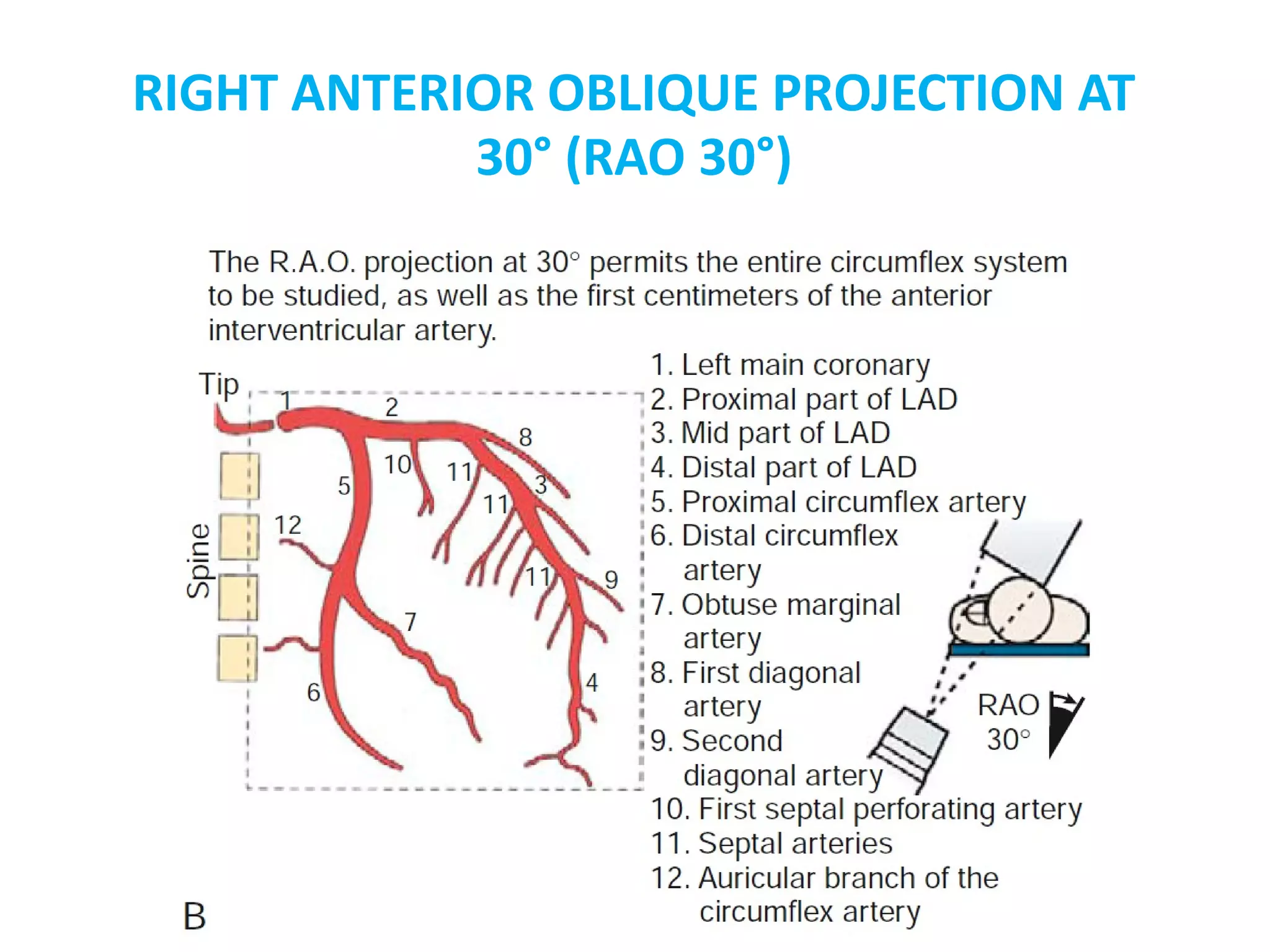 Identification of coronary arteries by different angiographic views ...