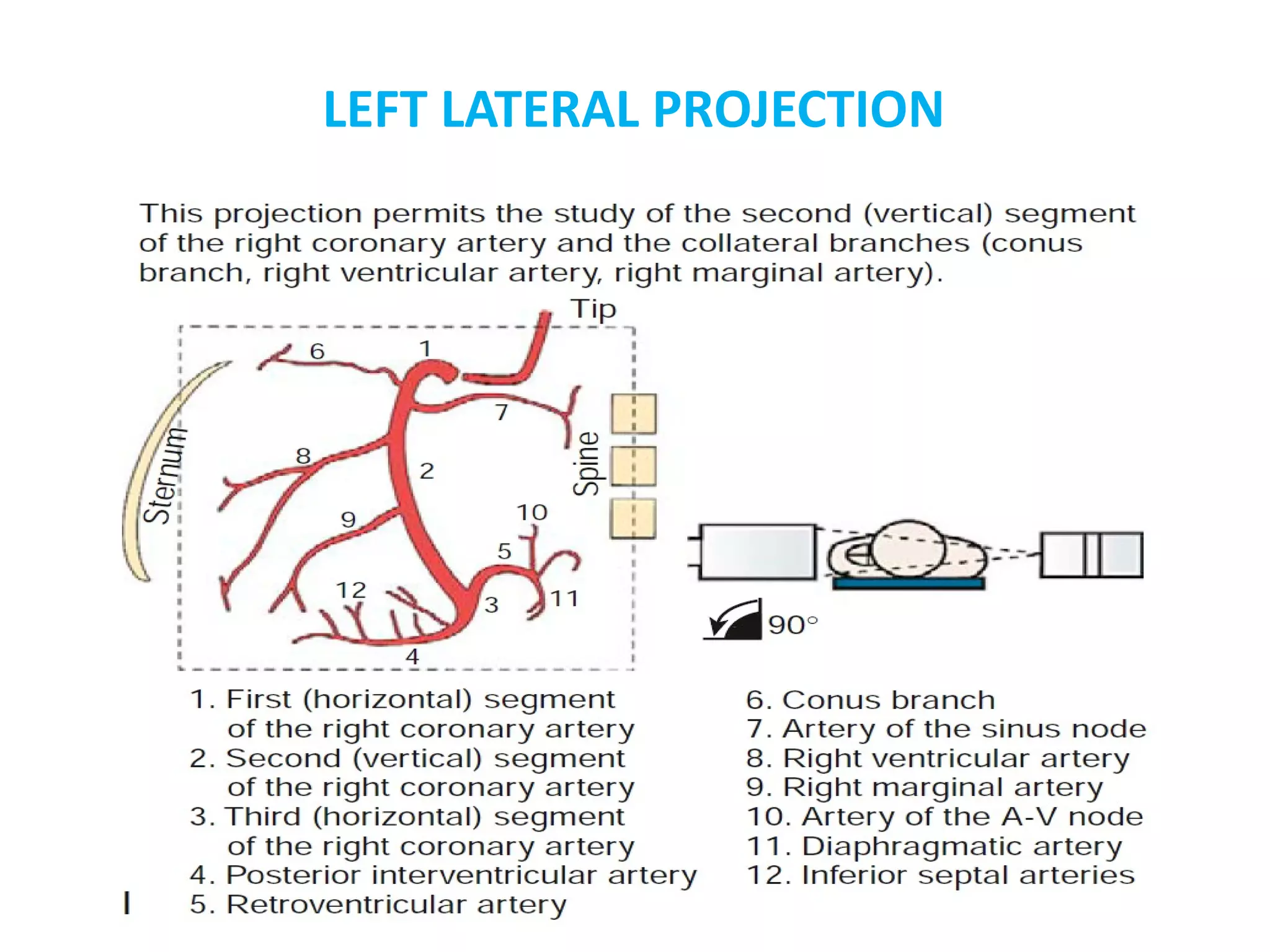 Identification of coronary arteries by different angiographic views ...