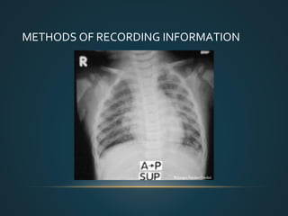 Plural Sign Radiograph Identification of Radiographs | PPT