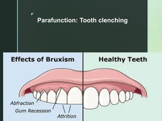 Identification of TMD & Chronic Orofacial Pain | PPTX