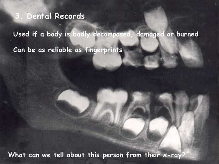 Identifying a dead body