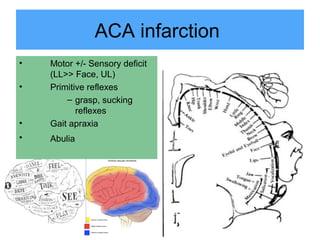 Identifying and managing acute stroke | PPT