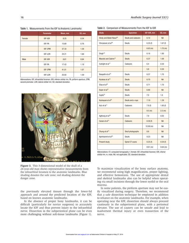 Identifying a safe zone for midface augmentation using anatomic