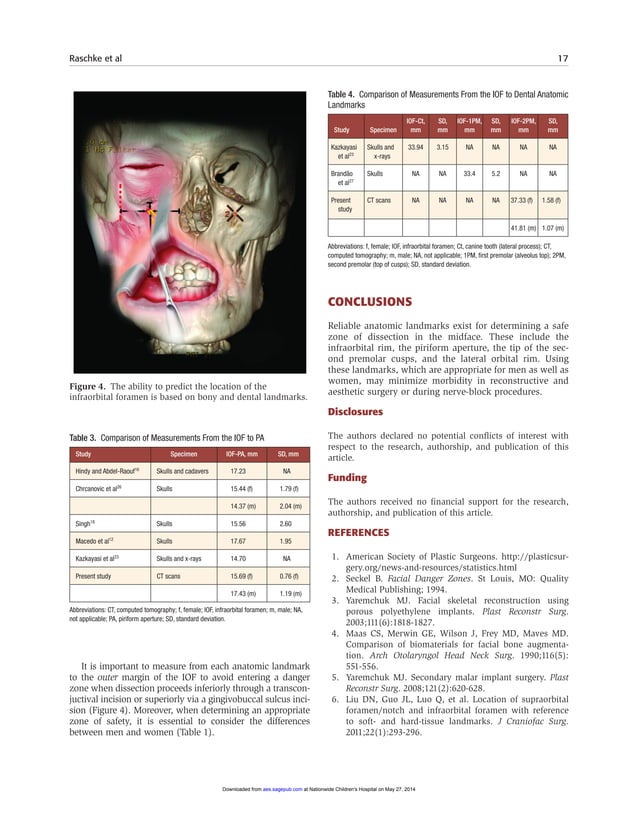 Identifying a safe zone for midface augmentation using anatomic