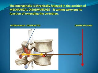 The Interspinalis is chronically fatigued in the position of
MECHANICAL DISADVANTAGE - it cannot carry out its
function of extending the vertebrae.


INTERSPINALIS CONTRACTED                           CENTER OF MASS
 