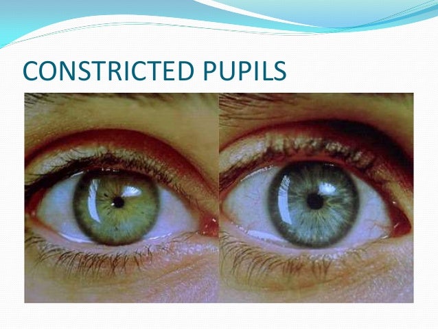 gabapentin overdose pupils