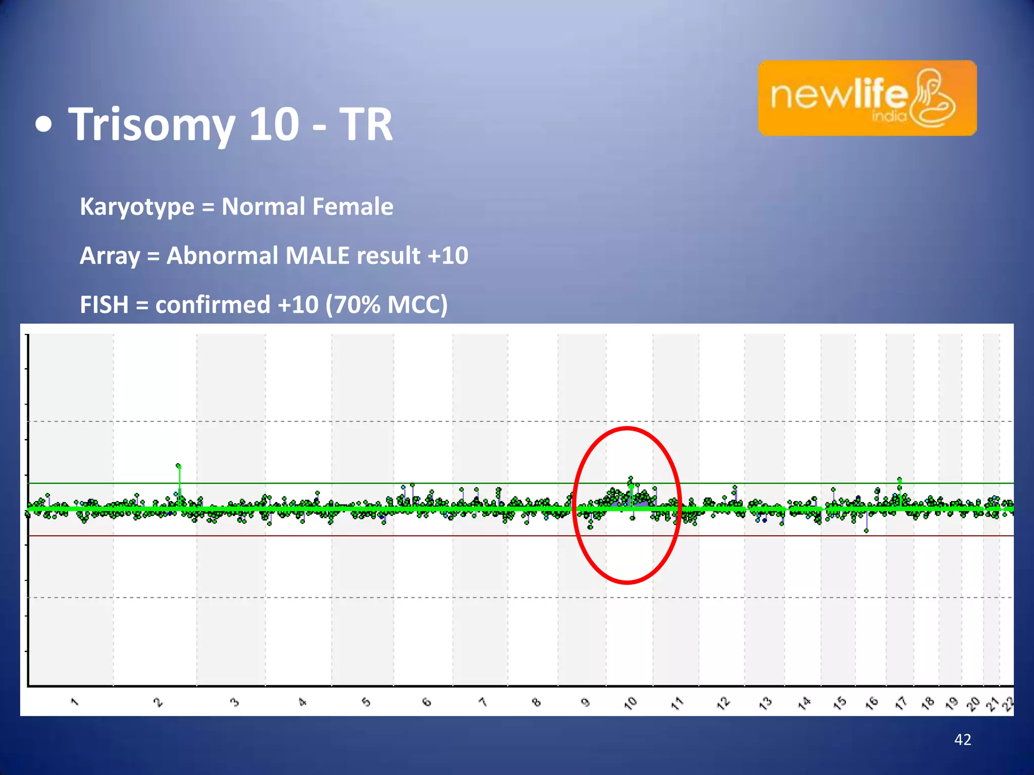 • Trisomy 10 - TR
Karyotype = Normal Female
Array = Abnormal MALE result +10
FISH = confirmed +10 (70% MCC)

42

 