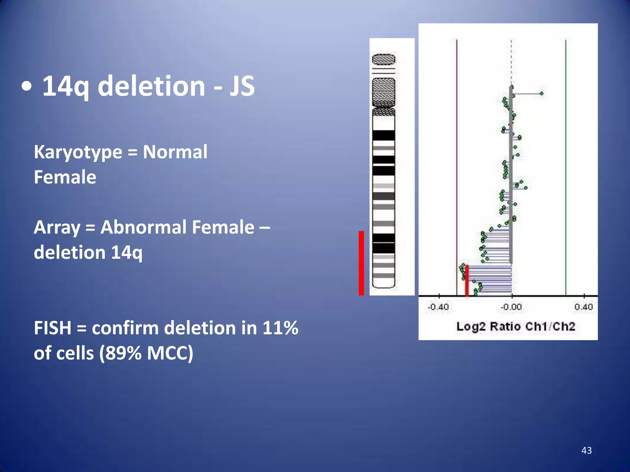 • 14q deletion - JS
Karyotype = Normal
Female
Array = Abnormal Female –
deletion 14q

FISH = confirm deletion in 11%
of cells (89% MCC)

43

 
