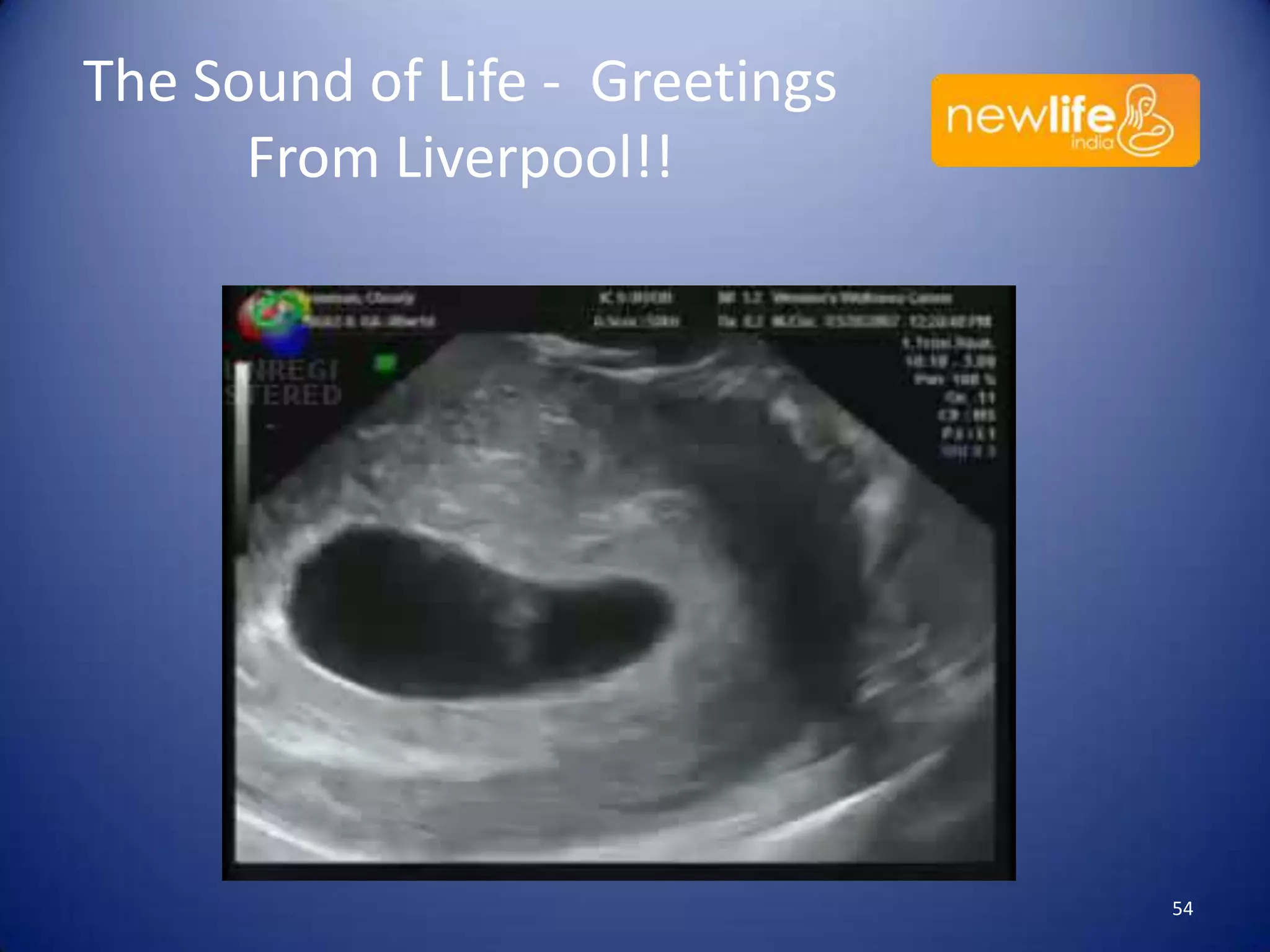 The Sound of Life - Greetings
From Liverpool!!

54

 